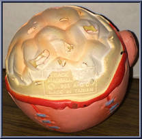 Crack Head from Madballs - Series 1 manufactured by AmToy [Loose]